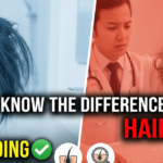 Hair Fall vs Hair-Shedding Know the Difference