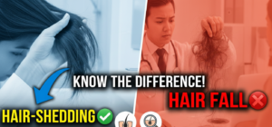 Hair Fall vs Hair-Shedding Know the Difference