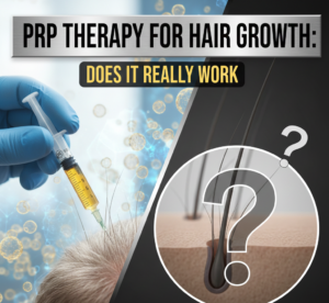 PRP Therapy for Hair Growth - Does it Really Work